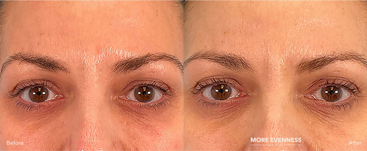 XOMD Throuple Bundle - Skin Care Meets Mood Care